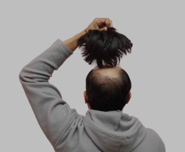 MONOFILAMENT Hair Patch